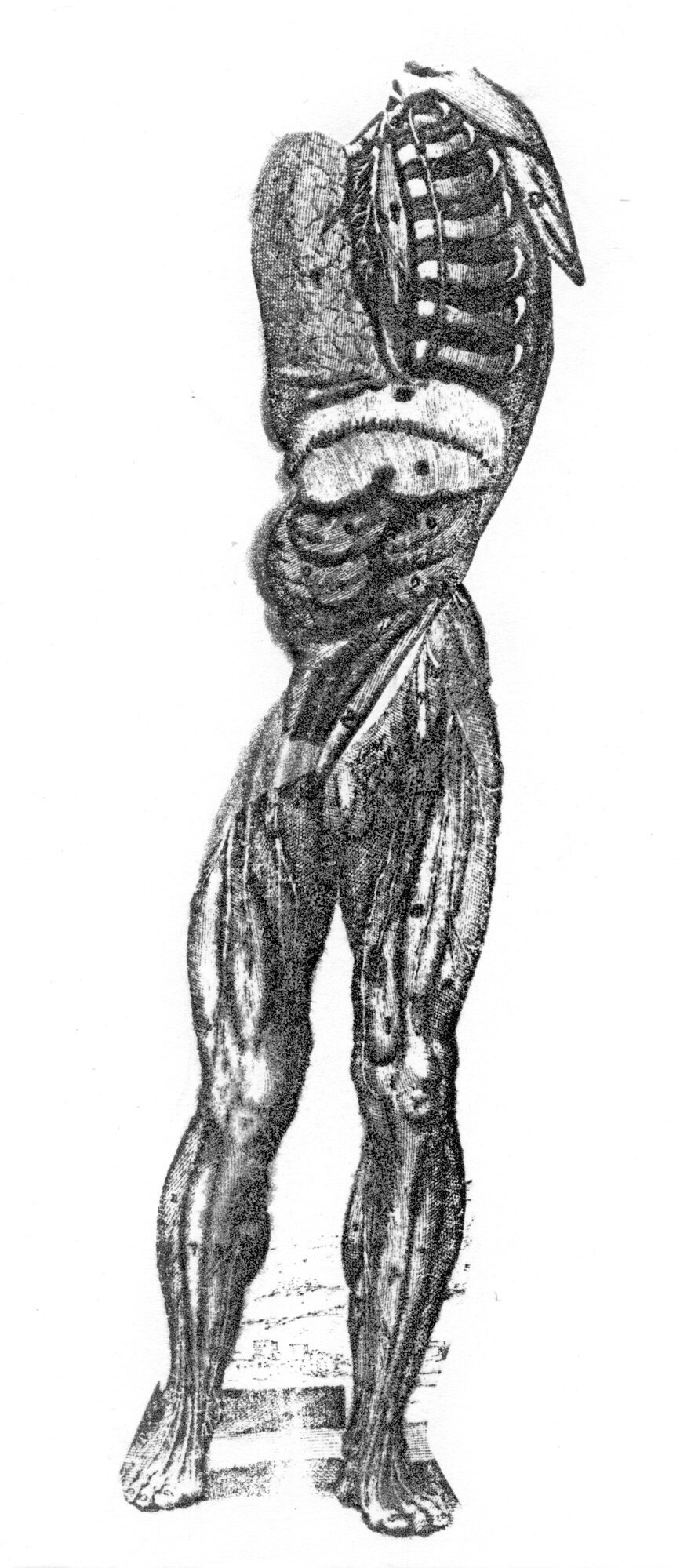 Disembodiment (Massacre)