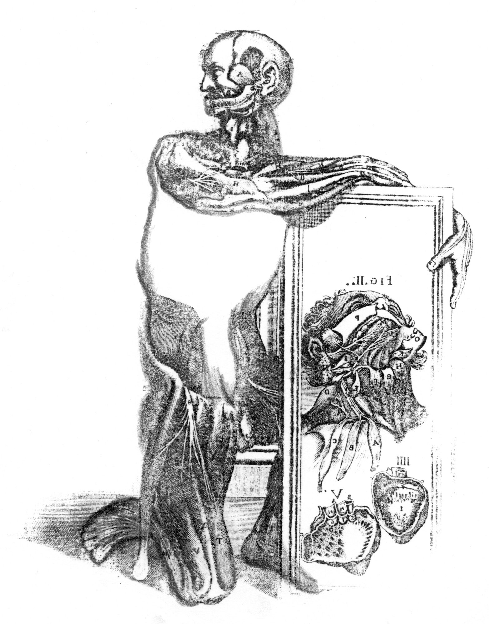 Disembodiment (Massacre)