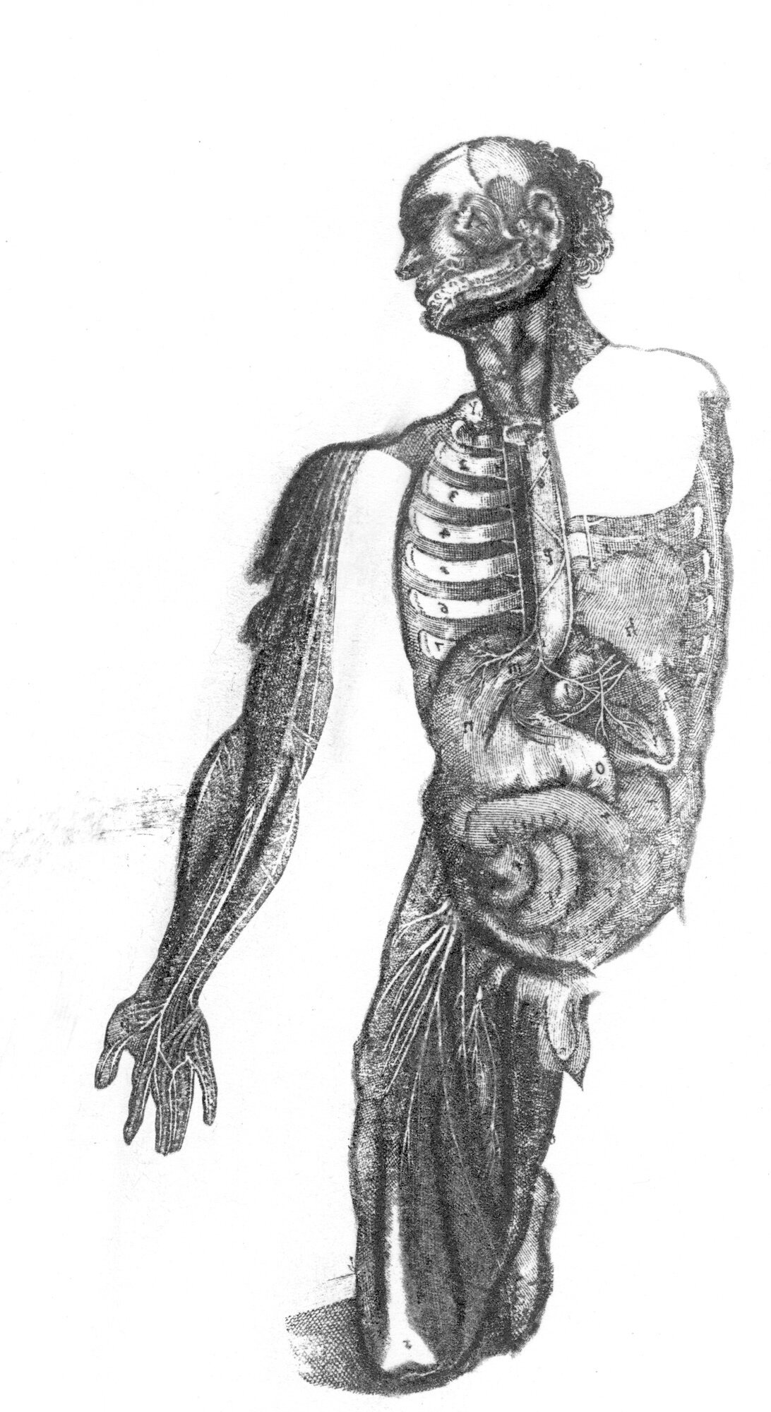 Disembodiment (Massacre)
