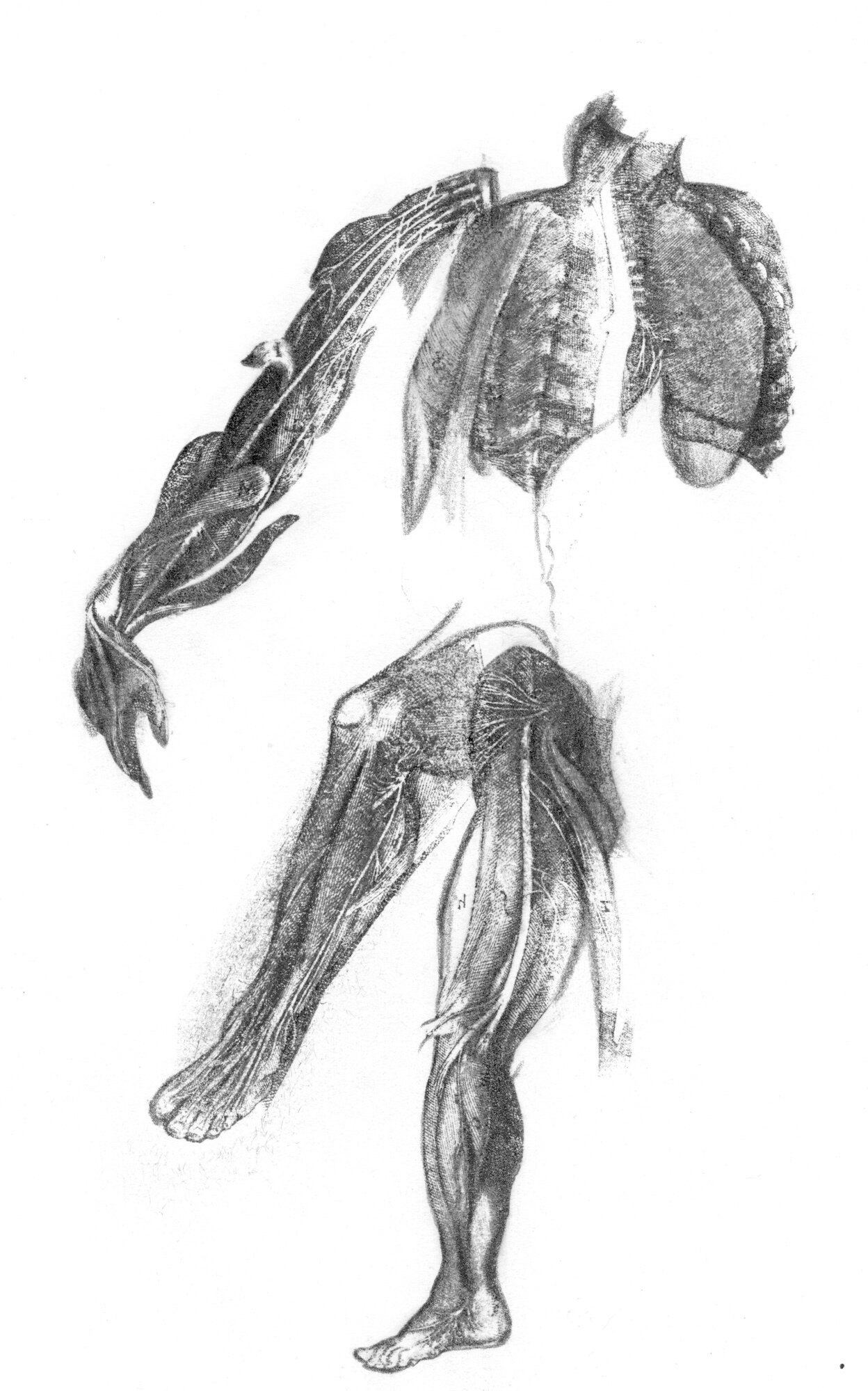 Disembodiment (Massacre)