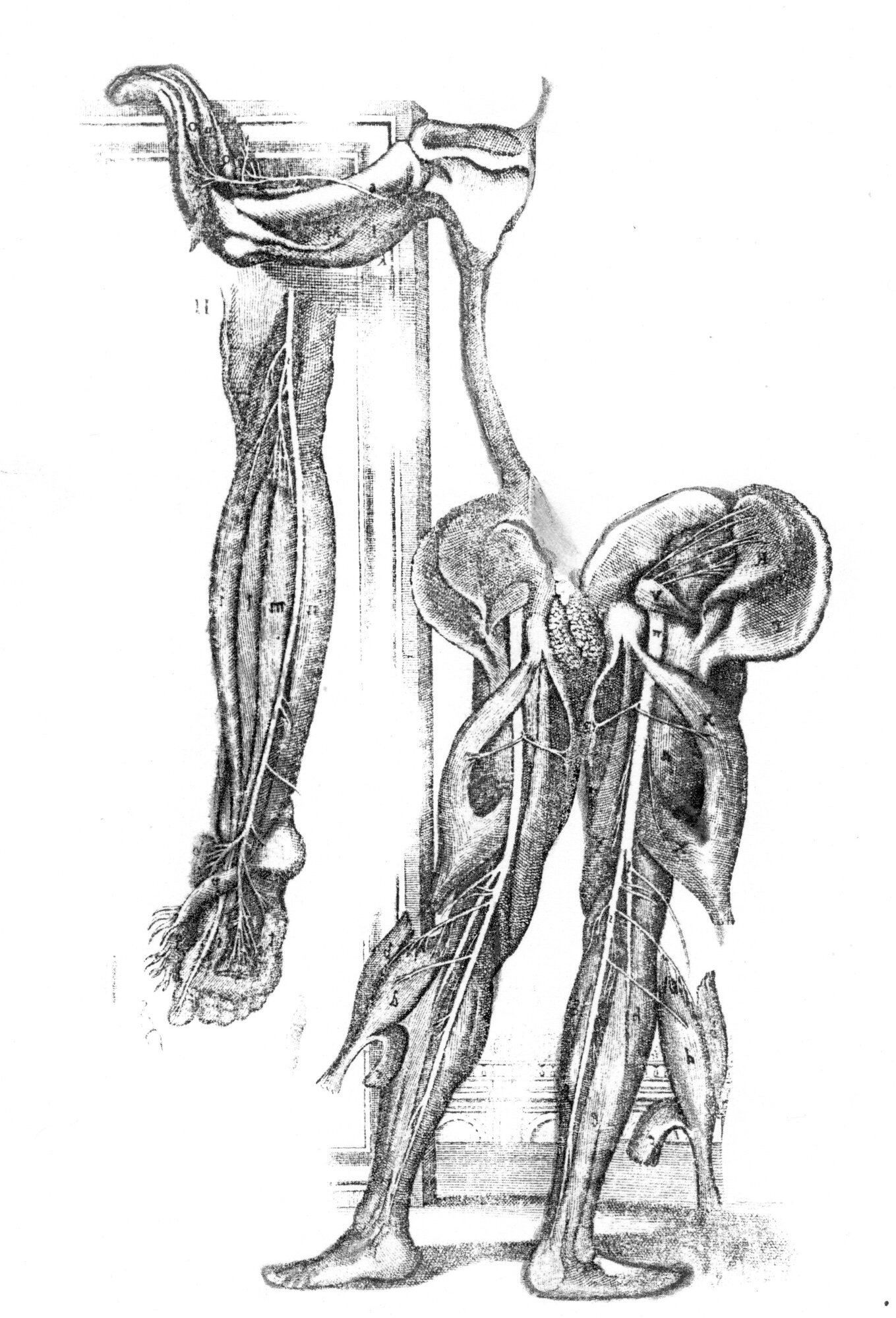 Disembodiment (Massacre)