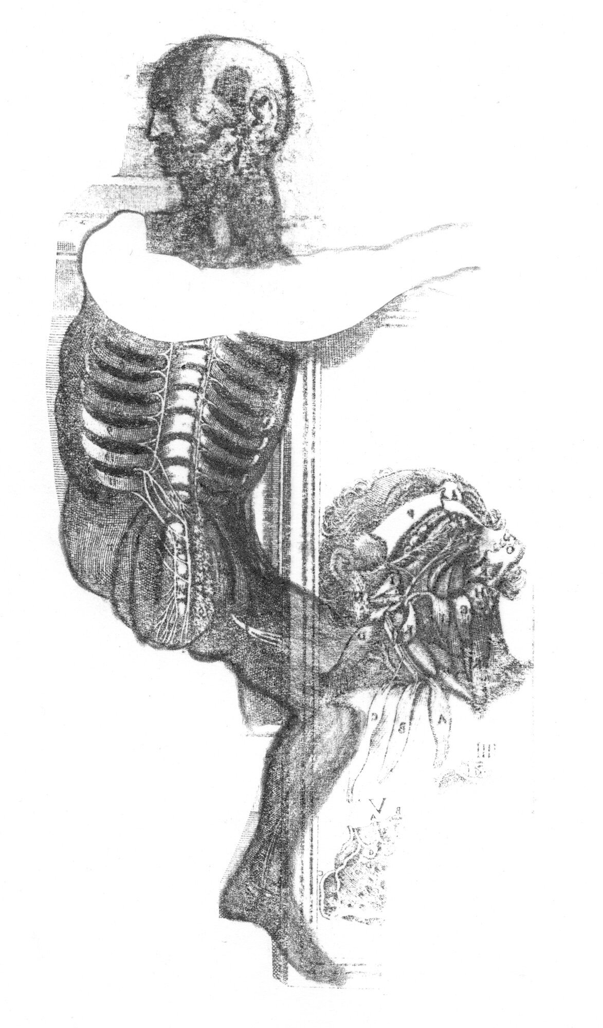 Disembodiment (Massacre)