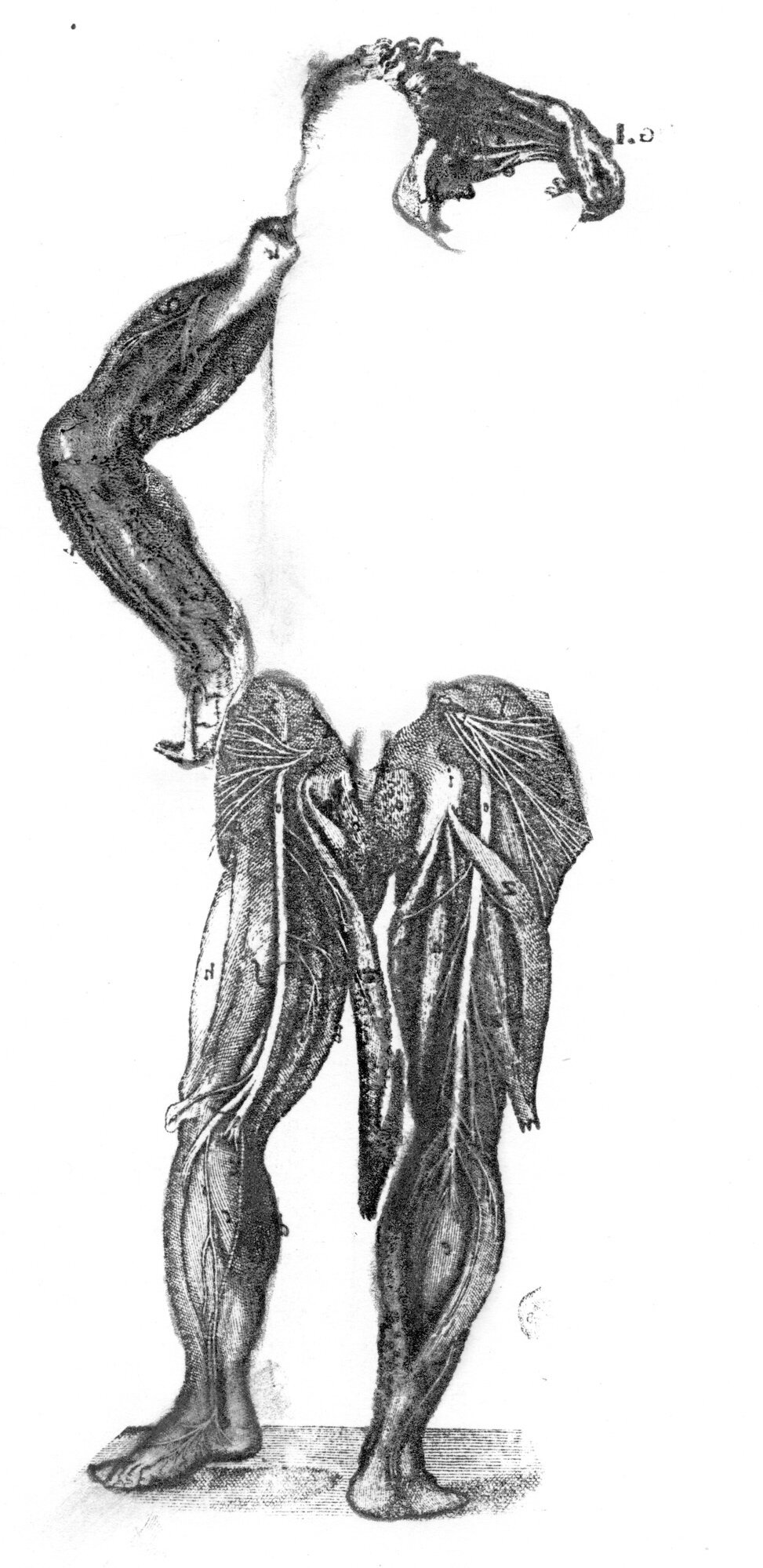 Disembodiment (Massacre)