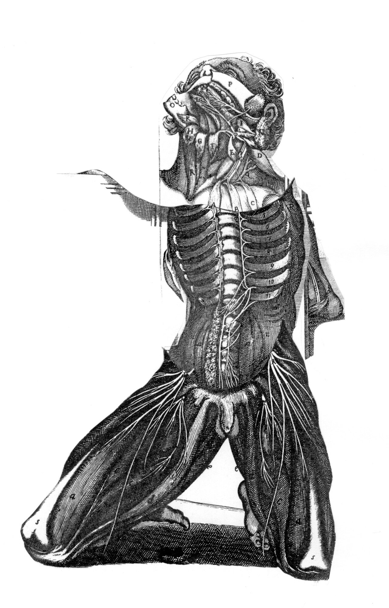 Disembodiment (Massacre)